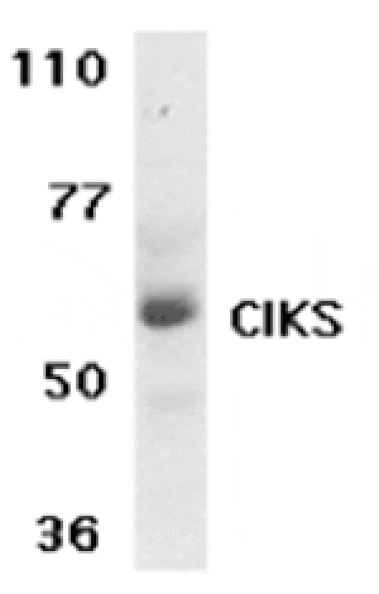 Western blot - CIKS Antibody from Signalway Antibody (24154) - Antibodies.com