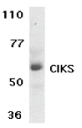 Western blot - CIKS Antibody from Signalway Antibody (24154) - Antibodies.com
