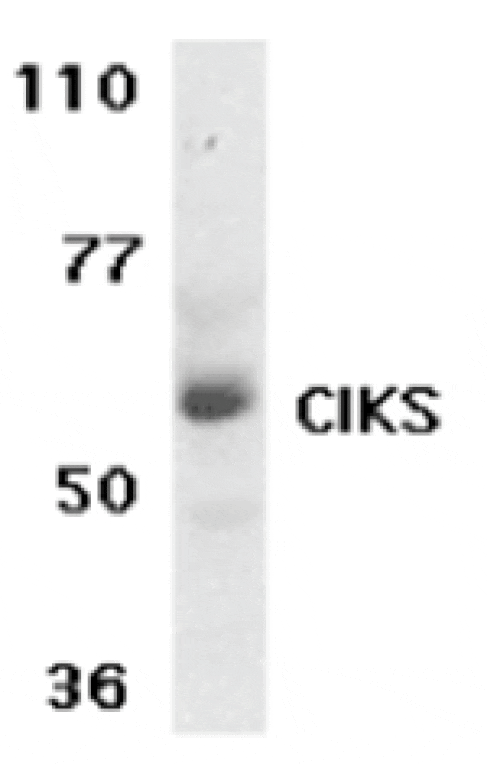 Western blot - CIKS Antibody from Signalway Antibody (24154) - Antibodies.com