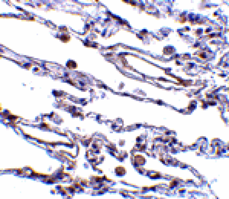 Immunohistochemistry - CIKS Antibody from Signalway Antibody (24154) - Antibodies.com