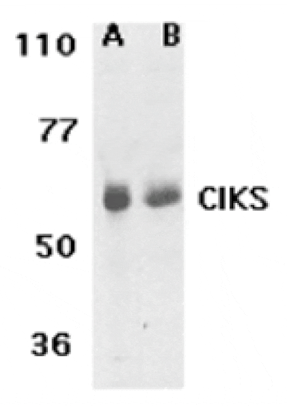 Western blot - CIKS Antibody from Signalway Antibody (24155) - Antibodies.com