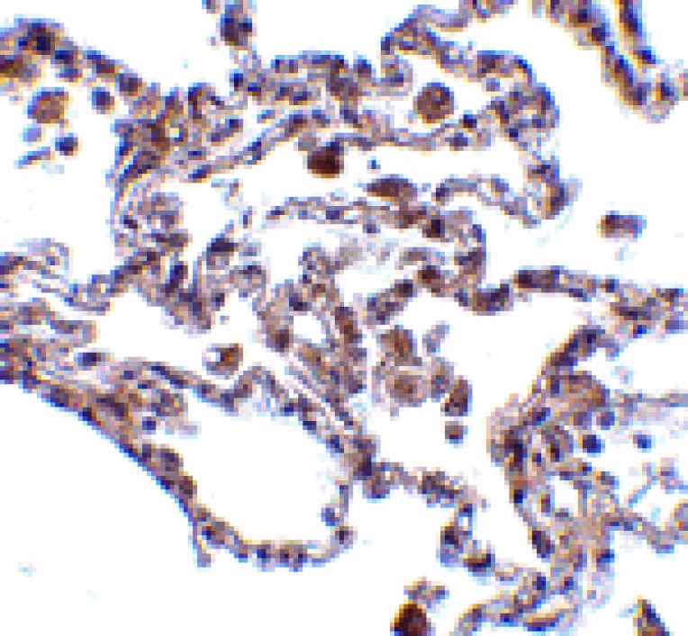 Immunohistochemistry - CIKS Antibody from Signalway Antibody (24155) - Antibodies.com