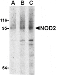 Western blot - NOD2 Antibody from Signalway Antibody (24158) - Antibodies.com