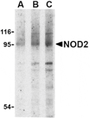 Western blot - NOD2 Antibody from Signalway Antibody (24158) - Antibodies.com