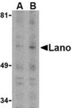Western blot - Lano Antibody from Signalway Antibody (24161) - Antibodies.com