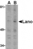 Western blot - Lano Antibody from Signalway Antibody (24161) - Antibodies.com