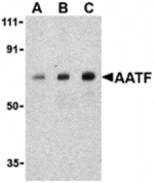 Western blot - AATF Antibody from Signalway Antibody (24174) - Antibodies.com