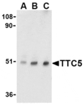 Western blot - TTC5 Antibody from Signalway Antibody (24179) - Antibodies.com