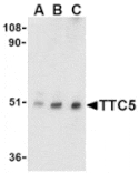 Western blot - TTC5 Antibody from Signalway Antibody (24179) - Antibodies.com