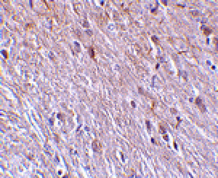 Immunohistochemistry - TTC5 Antibody from Signalway Antibody (24179) - Antibodies.com