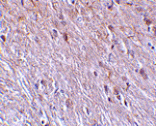 Immunohistochemistry - TTC5 Antibody from Signalway Antibody (24179) - Antibodies.com