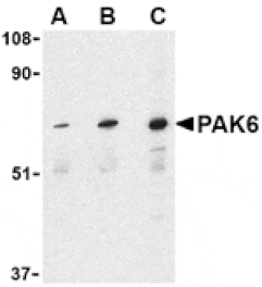 Western blot - PAK6 Antibody from Signalway Antibody (24181) - Antibodies.com