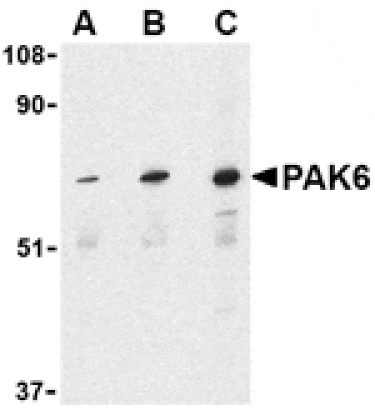 Western blot - PAK6 Antibody from Signalway Antibody (24181) - Antibodies.com