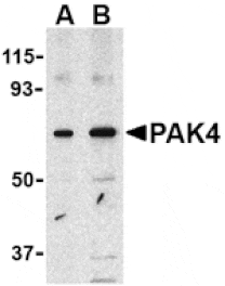 Western blot - PAK4 Antibody from Signalway Antibody (24183) - Antibodies.com