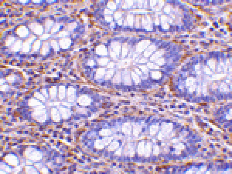 Immunohistochemistry - PAK4 Antibody from Signalway Antibody (24183) - Antibodies.com
