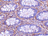 Immunohistochemistry - PAK4 Antibody from Signalway Antibody (24183) - Antibodies.com