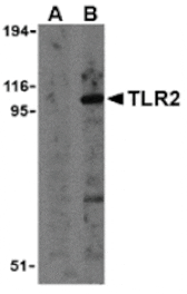 Western blot - TLR2 Antibody from Signalway Antibody (24192) - Antibodies.com