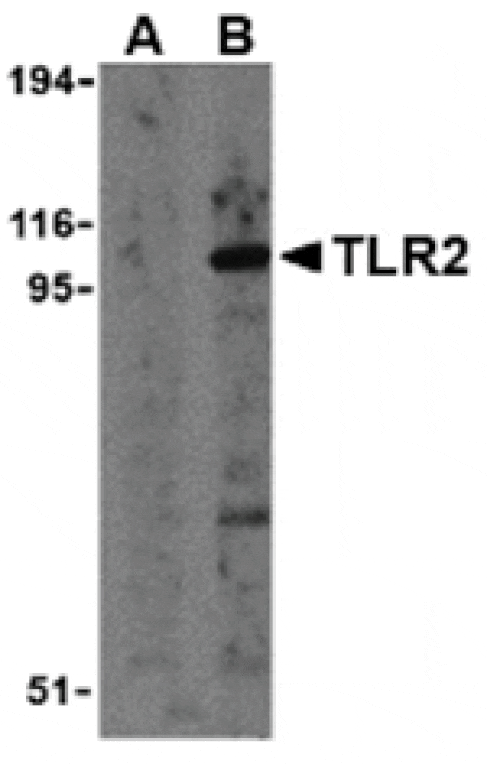 Western blot - TLR2 Antibody from Signalway Antibody (24192) - Antibodies.com