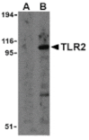 Western blot - TLR2 Antibody from Signalway Antibody (24192) - Antibodies.com