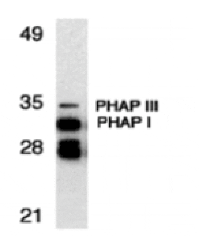 Western blot - PHAP Antibody from Signalway Antibody (24199) - Antibodies.com