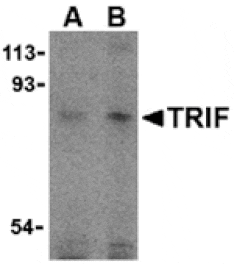 Western blot - TRIF Antibody from Signalway Antibody (24205) - Antibodies.com