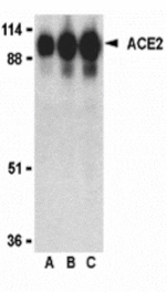 Western blot - ACE2 Antibody from Signalway Antibody (24214) - Antibodies.com