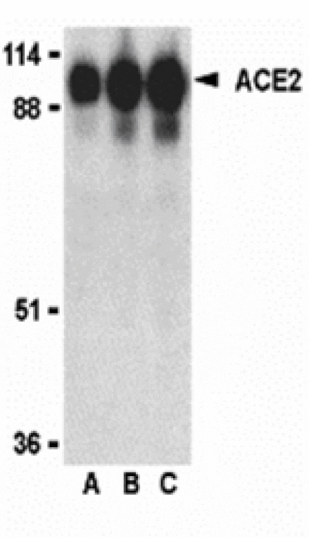 Western blot - ACE2 Antibody from Signalway Antibody (24214) - Antibodies.com