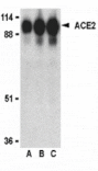 Western blot - ACE2 Antibody from Signalway Antibody (24214) - Antibodies.com