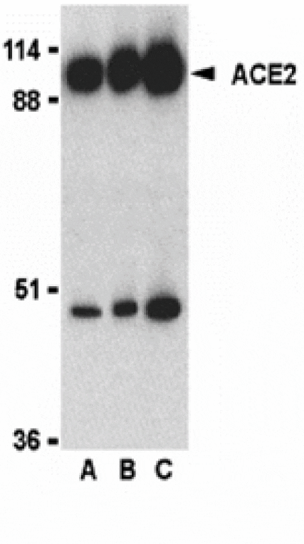 Western blot - ACE2 Antibody from Signalway Antibody (24215) - Antibodies.com