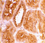 Immunohistochemistry - ACE2 Antibody from Signalway Antibody (24215) - Antibodies.com