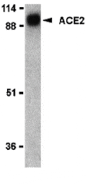 Western blot - ACE2 Antibody from Signalway Antibody (24220) - Antibodies.com