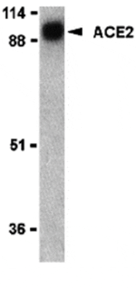 Western blot - ACE2 Antibody from Signalway Antibody (24220) - Antibodies.com