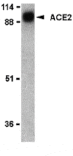 Western blot - ACE2 Antibody from Signalway Antibody (24220) - Antibodies.com