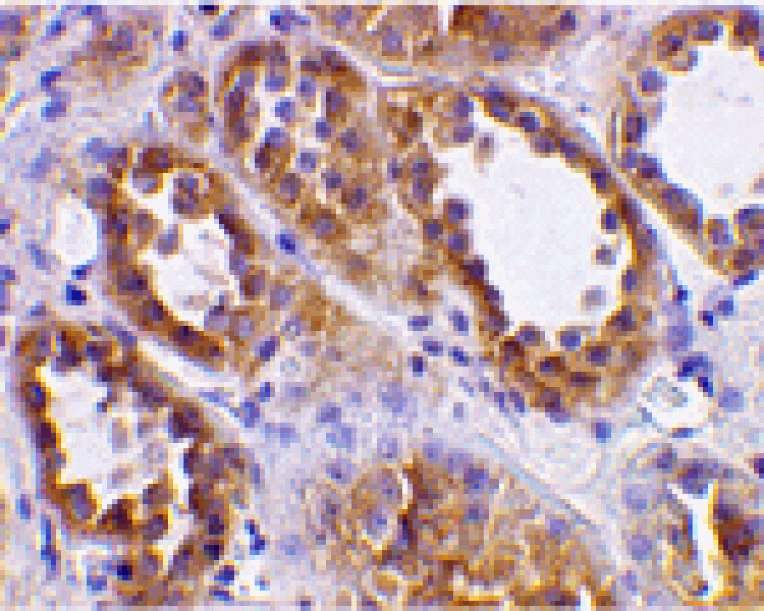 Immunohistochemistry - ACE2 Antibody from Signalway Antibody (24220) - Antibodies.com