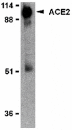 Western blot - ACE2 Antibody from Signalway Antibody (24221) - Antibodies.com