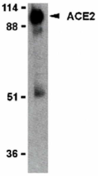 Western blot - ACE2 Antibody from Signalway Antibody (24221) - Antibodies.com