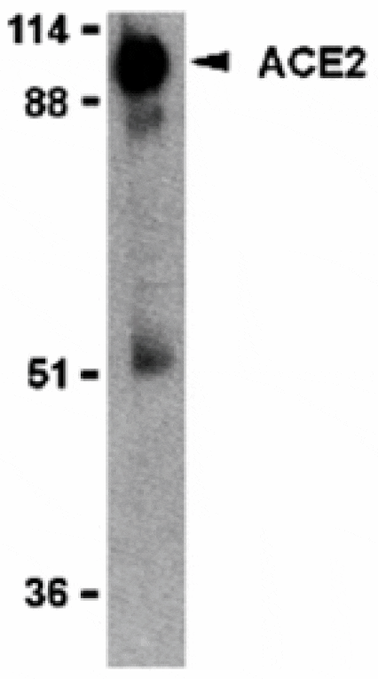 Western blot - ACE2 Antibody from Signalway Antibody (24221) - Antibodies.com