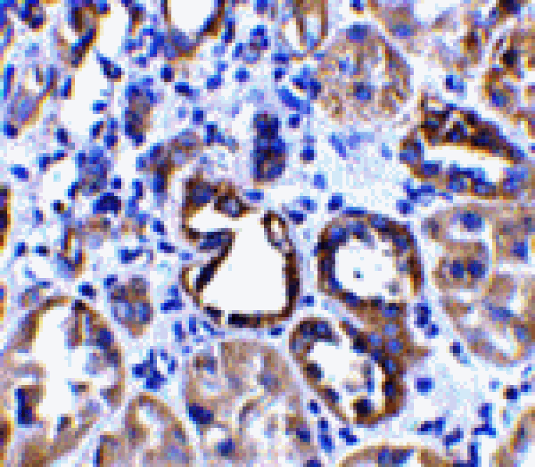 Immunohistochemistry - ACE2 Antibody from Signalway Antibody (24221) - Antibodies.com