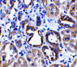 Immunohistochemistry - ACE2 Antibody from Signalway Antibody (24221) - Antibodies.com