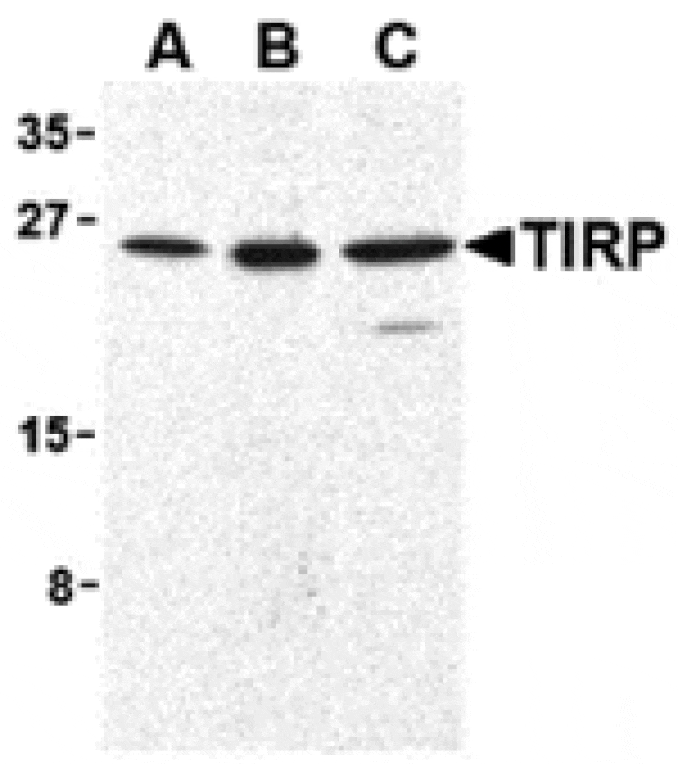 Western blot - TIRP Antibody from Signalway Antibody (24237) - Antibodies.com