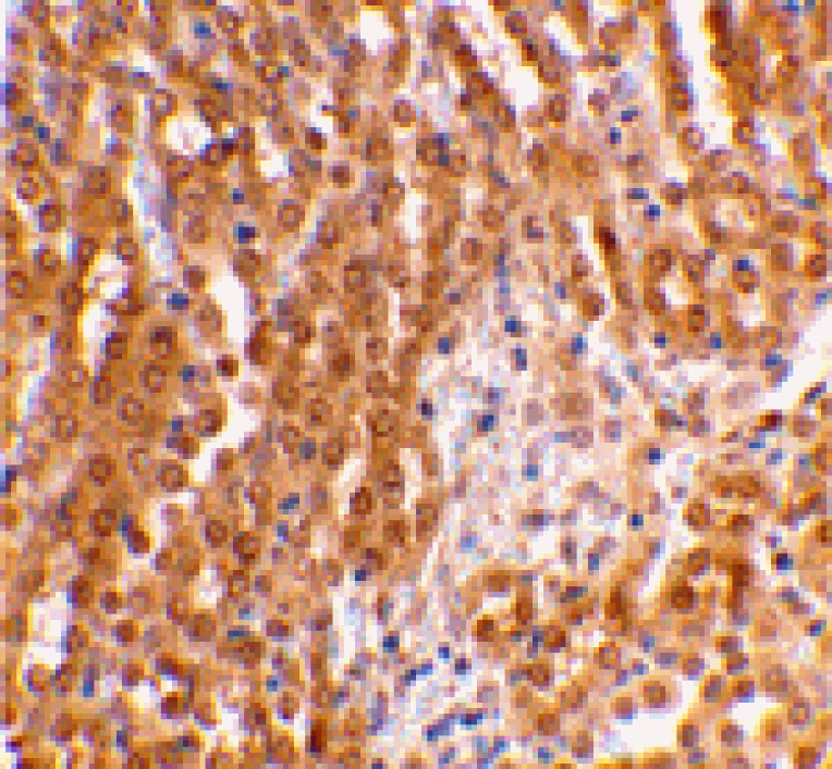 Immunohistochemistry - TIRP Antibody from Signalway Antibody (24237) - Antibodies.com