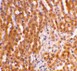 Immunohistochemistry - TIRP Antibody from Signalway Antibody (24237) - Antibodies.com