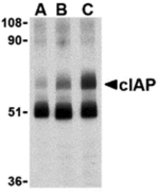 Western blot - cIAP Antibody from Signalway Antibody (24243) - Antibodies.com