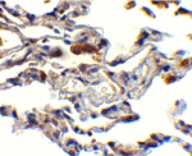 Immunohistochemistry - cIAP Antibody from Signalway Antibody (24243) - Antibodies.com