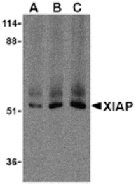 Western blot - XIAP Antibody from Signalway Antibody (24244) - Antibodies.com