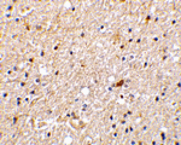 Immunohistochemistry - NADE Antibody from Signalway Antibody (24254) - Antibodies.com