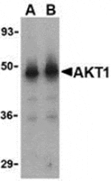 Western blot - Akt1 Antibody from Signalway Antibody (24316) - Antibodies.com