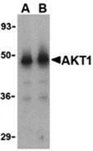 Western blot - Akt1 Antibody from Signalway Antibody (24316) - Antibodies.com