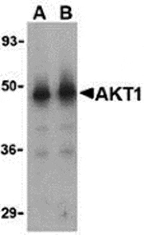 Western blot - Akt1 Antibody from Signalway Antibody (24316) - Antibodies.com