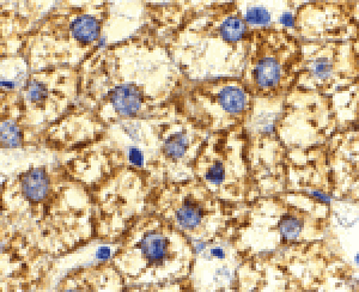 Immunohistochemistry - Akt1 Antibody from Signalway Antibody (24316) - Antibodies.com